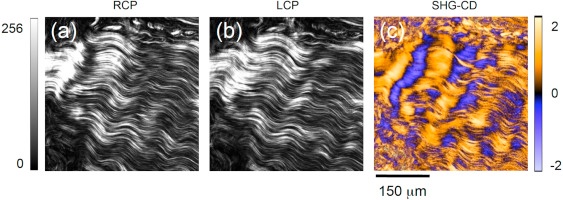 Resonant nonlinear microscopy reveals changes in molecular level chirality in native biological tissues